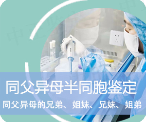 德宏同父异母半同胞鉴定
